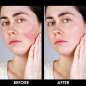 Couperoll Double Serum