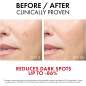 Liftactiv Pigment Specialist B3