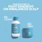 Invigo Scalp Balance