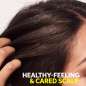Invigo Scalp Balance Invigo Scalp Balance