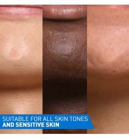 Blemish Control Barrier Patches