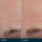 Pro-Collagen Future Restore Serum Pro-Collagen Future Restore Serum