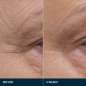 Pro-Collagen Future Restore Serum