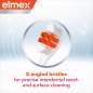 Expert Precision Interdental