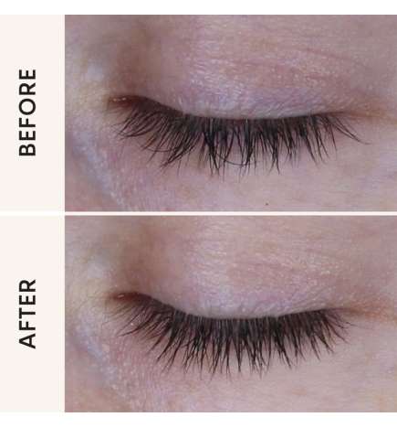 PRO Growth Serum