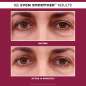 EVEN SMOOTHER™ Glycolic Retinol Hydra-Gel Eye Patches
