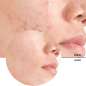 JUST Salicylic Acid 2%