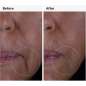 Growth Factors Solution