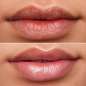 Lip Rehab Therapy Oil